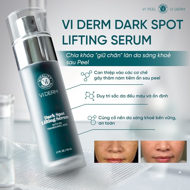 Top 7 serum l&agrave;m mờ n&aacute;m đậm, n&aacute;m s&acirc;u tới đ&acirc;u cũng hiệu quả- Ảnh 2.