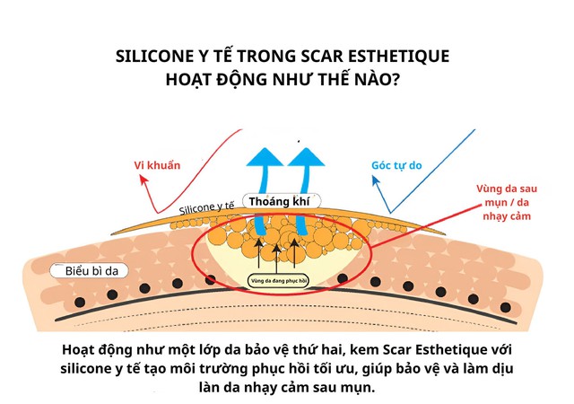 Da sau mụn: Giải m&atilde; tiến tr&igrave;nh phục hồi sinh học dưới g&oacute;c độ chuy&ecirc;n gia- Ảnh 3.