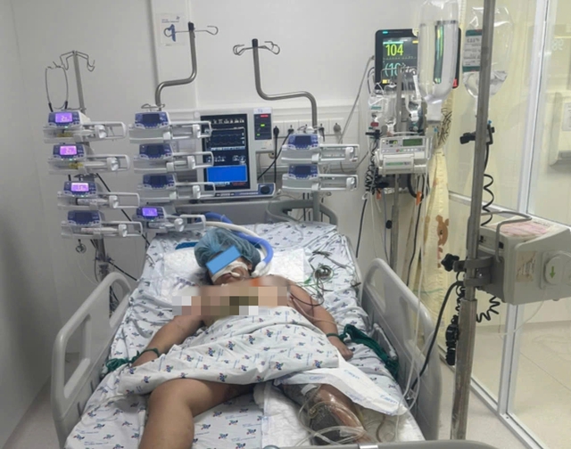 Bệnh viện Nhi đồng th&agrave;nh phố cứu b&eacute; g&aacute;i 9 tuổi bị l&oacute;c da nghi&ecirc;m trọng v&igrave; tai nạn- Ảnh 1.