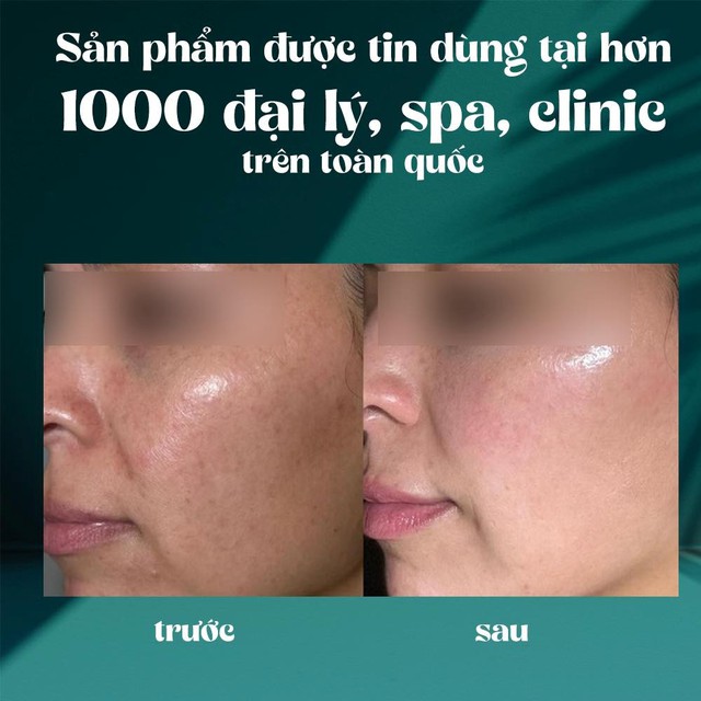 Chị em U30+ cứ ngỡ 20 nhờ top 6 kem dưỡng da, vừa kịp đón Tết 2026 - Ảnh 3.