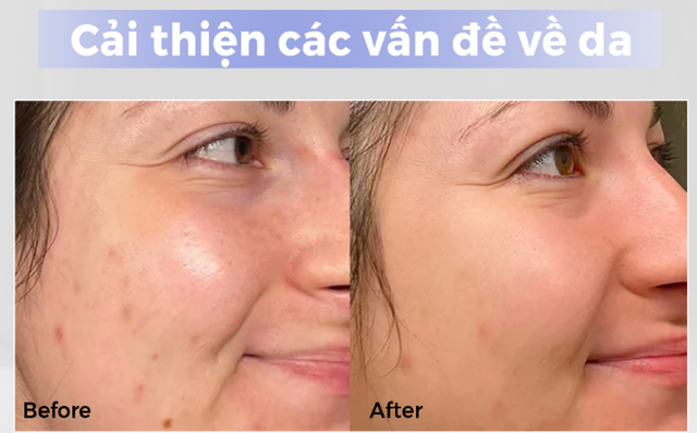 Chị em U30+ cứ ngỡ 20 nhờ top 6 kem dưỡng da, vừa kịp đón Tết 2026 - Ảnh 7.