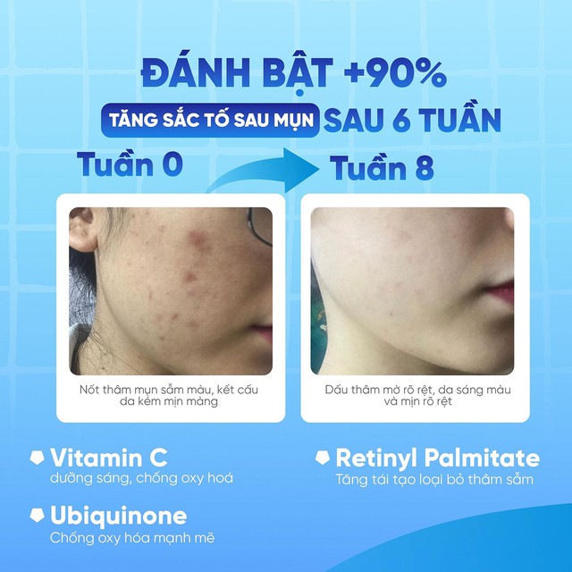 Hiệu quả l&acirc;m s&agrave;ng cho thấy c&ocirc;ng dụng cải thiện nền da sau breakout của Scar Esthetique - Ảnh 3.