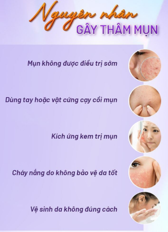 L&agrave;m đẹp da l&aacute;ng mịn kh&ocirc;ng th&acirc;m mụn Nhờ skincare chuẩn y khoa tại nh&agrave; - Ảnh 4.