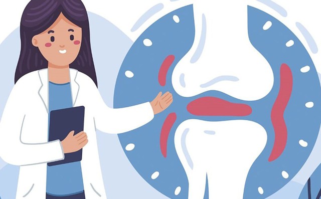 Giải mã chìa khóa bảo vệ sức khỏe cơ xương khớp- Ảnh 1. Giải mã chìa khóa bảo vệ sức khỏe cơ xương khớp- Ảnh 1.