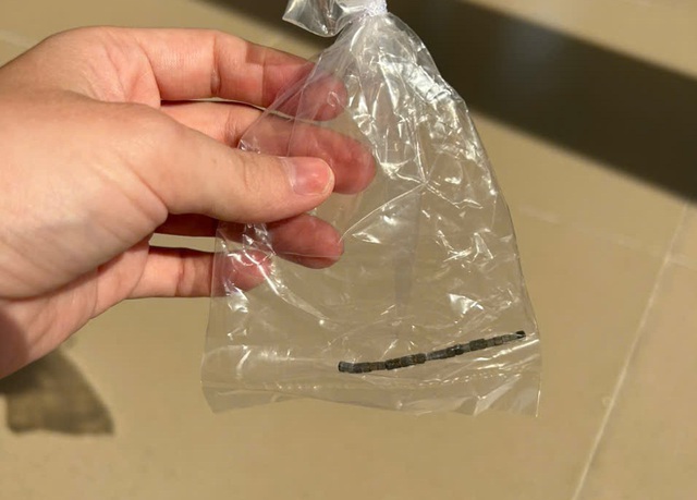 B&eacute; trai 2,5 tuổi bị thủng ruột 10 lỗ, nghi c&aacute;c vi&ecirc;n nam ch&acirc;m nhỏ g&acirc;y ra. - Ảnh 1.