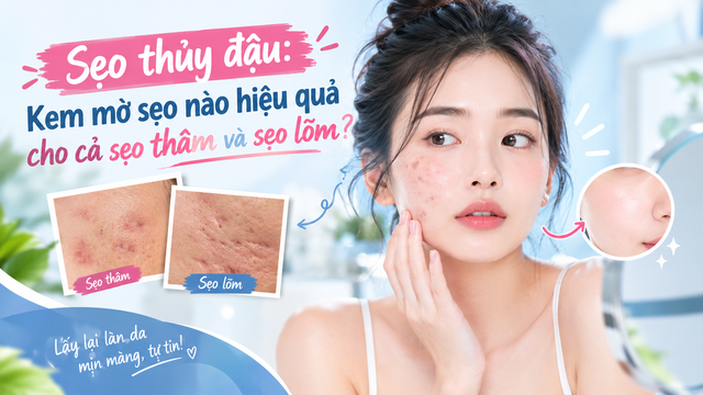 Sẹo thủy đậu: Kem mờ sẹo nào hiệu quả cho cả sẹo thâm và sẹo lõm? - Ảnh 1.