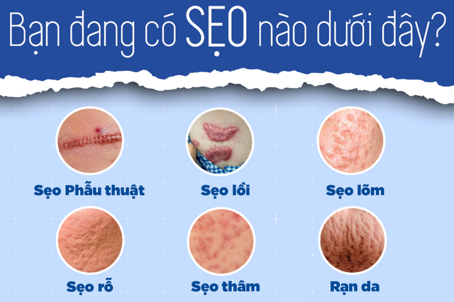 Sẹo trên mặt phải làm sao khi đã dùng đủ loại kem vẫn không cải thiện? - Ảnh 1.