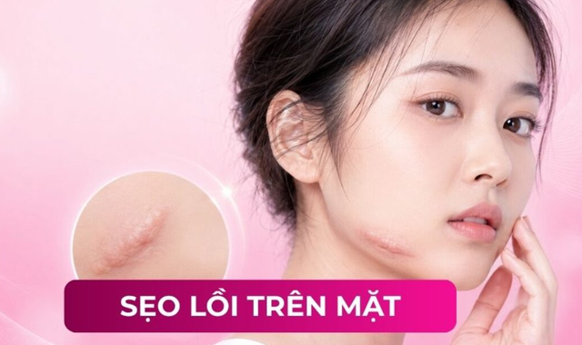 Sẹo trên mặt phải làm sao khi đã dùng đủ loại kem vẫn không cải thiện? - Ảnh 2.