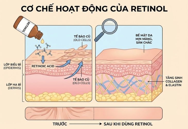 Retinol cho người mới bắt đầu: Đừng để nỗi sợ kích ứng mà quên ‘hoạt chất vàng’ - Ảnh 2.
