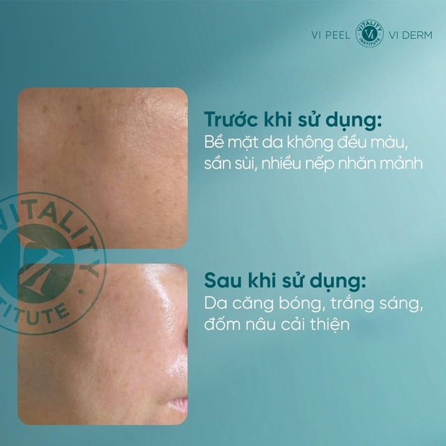 Retinol cho người mới bắt đầu: Đừng để nỗi sợ kích ứng mà quên ‘hoạt chất vàng’ - Ảnh 9.