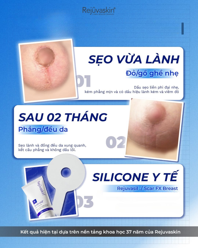 Phác đồ ‘ngày một lớp, đêm một lớp’ giúp sẹo mờ, mềm hơn sau khoảng 4-6 tuần - Ảnh 3.