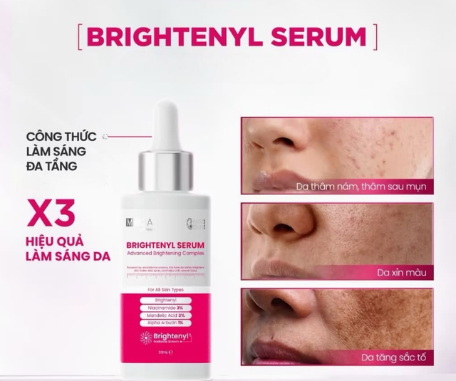 Top 5 kem gi&uacute;p mờ n&aacute;m ch&acirc;n s&acirc;u, đốm n&acirc;u hiệu quả sau khoảng 4 tuần - Ảnh 7.