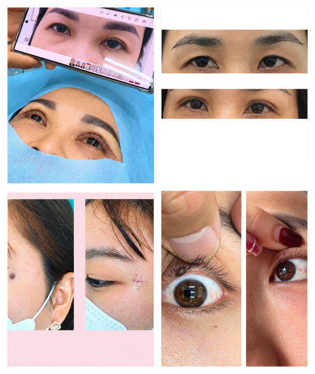 Bác sĩ thẩm mỹ làm đẹp cho hàng ngàn bệnh nhân tại BV Da liễu Cần Thơ - Ảnh 2.