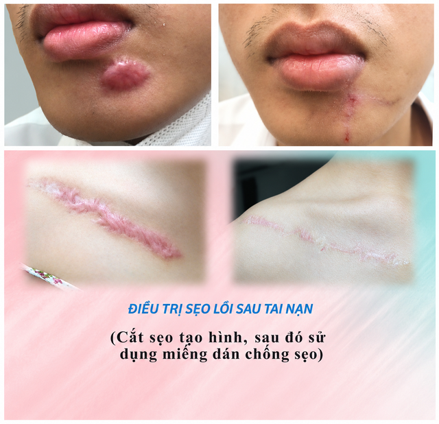 Bác sĩ thẩm mỹ làm đẹp cho hàng ngàn bệnh nhân tại BV Da liễu Cần Thơ - Ảnh 4.