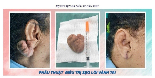 Bác sĩ thẩm mỹ làm đẹp cho hàng ngàn bệnh nhân tại BV Da liễu Cần Thơ - Ảnh 5.