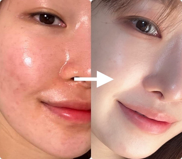 Da càng chăm càng già? Do bạn đang thiếu bước skincare retinol cho da lão hóa - Ảnh 4.