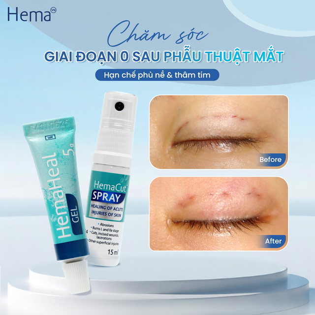 Chăm sóc sau thủ thuật thẩm mỹ: 5 câu nên hỏi trước khi ra về - Ảnh 5.