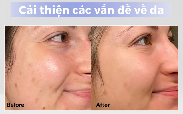 +7 kem dưỡng da mặt tốt nàng nào cũng muốn mua mà ‘cháy hàng liên tục’ - Ảnh 5.