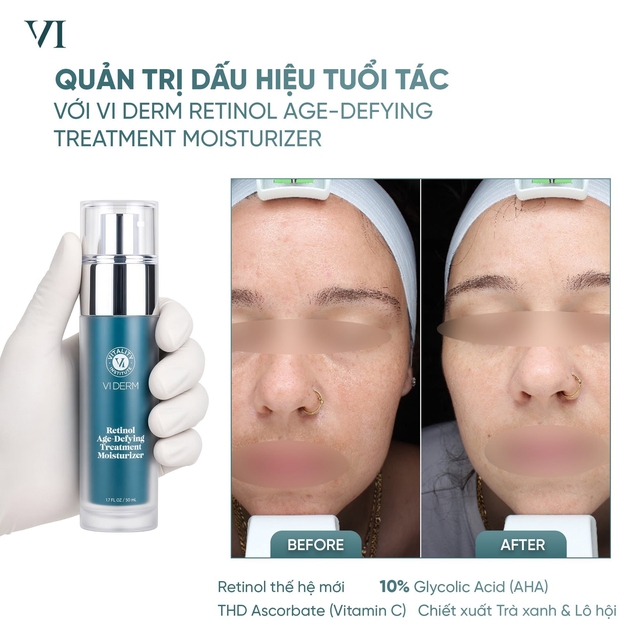 Top 7 kem dưỡng sáng da giúp U.30+ mặt mộc vẫn căng bóng, trẻ hơn tuổi thật - Ảnh 5.