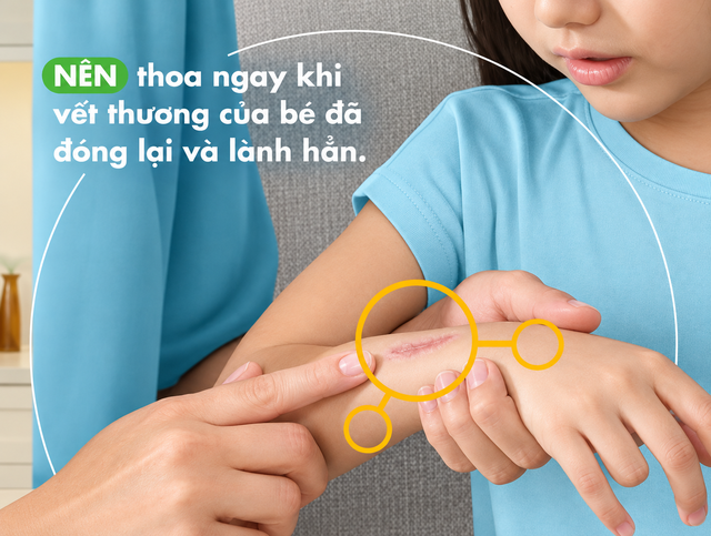 Kem bôi sẹo nào tốt cho bé đang được nhiều bố mẹ săn đón hiện nay? - Ảnh 6.
