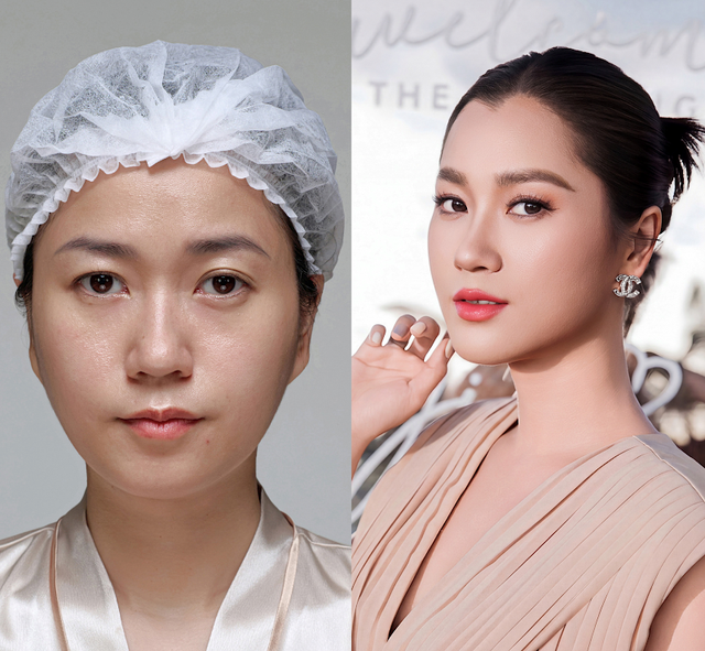 BS Thái Như Ngọc chia sẻ phương pháp trẻ hóa qua trường hợp DV Lâm Vỹ Dạ- Ảnh 2.