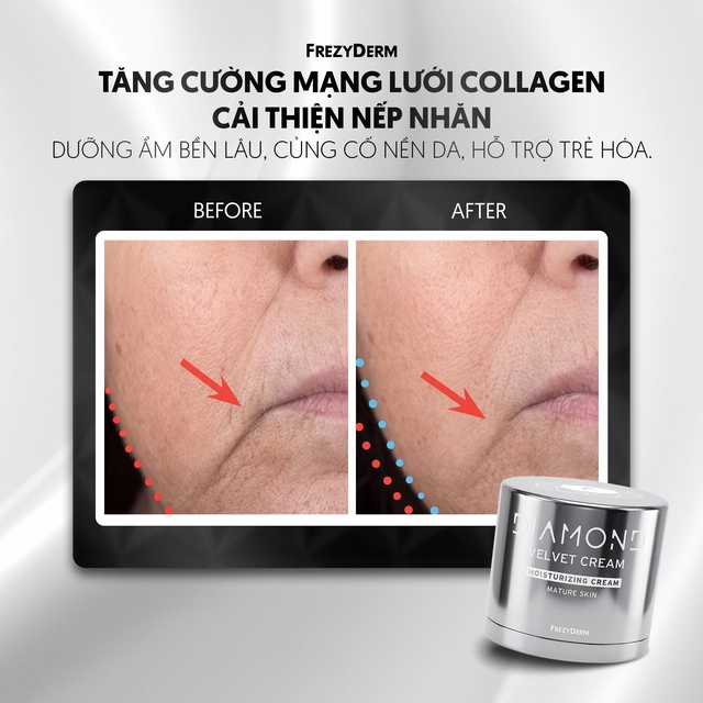 Top 3 kem dưỡng cho da 35+ cải thiện nếp nhăn, tuổi tác chỉ là con số - Ảnh 3.