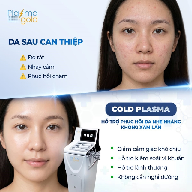 Cold Plasma: ‘Bước tiến mới’ trong hỗ trợ điều trị sẹo rỗ và da lão hóa sâu - Ảnh 4.