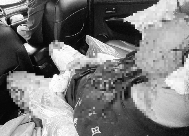 Làm rõ vụ nữ sinh lớp 11 nghi dùng dao tấn công nữ sinh lớp 9 - Ảnh 1.