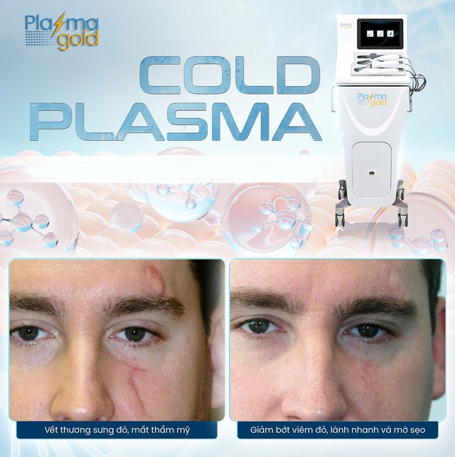 Mua m&aacute;y Plasma Lạnh ở đ&acirc;u để spa đầu tư kh&ocirc;ng lo rủi ro?- Ảnh 4.