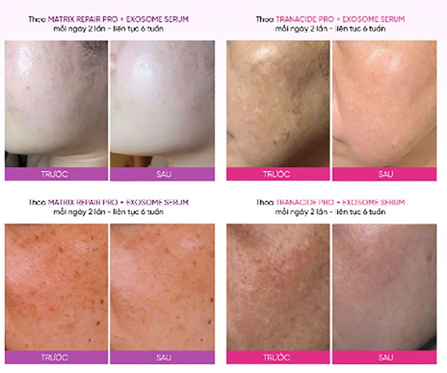 Top 6 kem chống l&atilde;o h&oacute;a gi&uacute;p l&agrave;n da tuổi 40 cải thiện căng trẻ như 20- Ảnh 7.