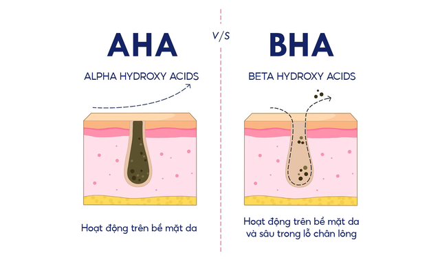 Da mụn nên dùng BHA hay AHA - phương pháp chăm da mụn chuẩn khoa học- Ảnh 3. Da mụn nên dùng BHA hay AHA - phương pháp chăm da mụn chuẩn khoa học- Ảnh 3.