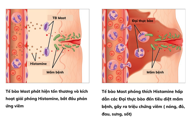 Kiểm so&aacute;t vi&ecirc;m sớm - Nền tảng khoa học trong ph&ograve;ng ngừa sẹo hậu phẫu - Ảnh 2.