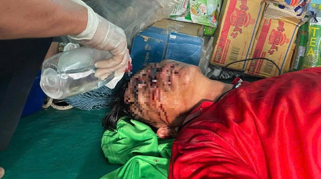 - Ảnh 2. - Ảnh 2.