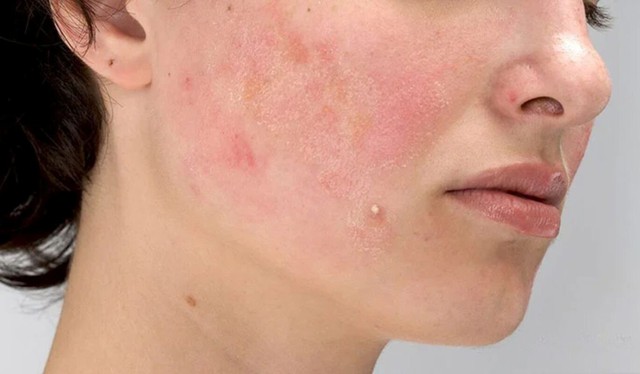 ‘Reset’ làn da sau Tết: Bắt đầu từ đâu để da hồi phục nhanh? - Ảnh 2.