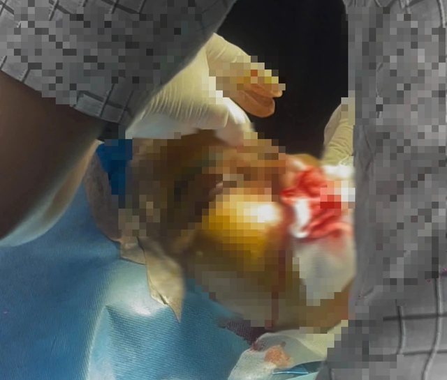 TP.HCM: Một người tử vong sau khi l&agrave;m đẹp bằng phương ph&aacute;p 'truyền trắng da' - Ảnh 1.