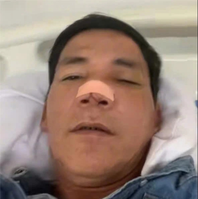 Cầu cứu vì bị nhóm người đánh gãy sống mũi ngay trước nhà - Ảnh 1.