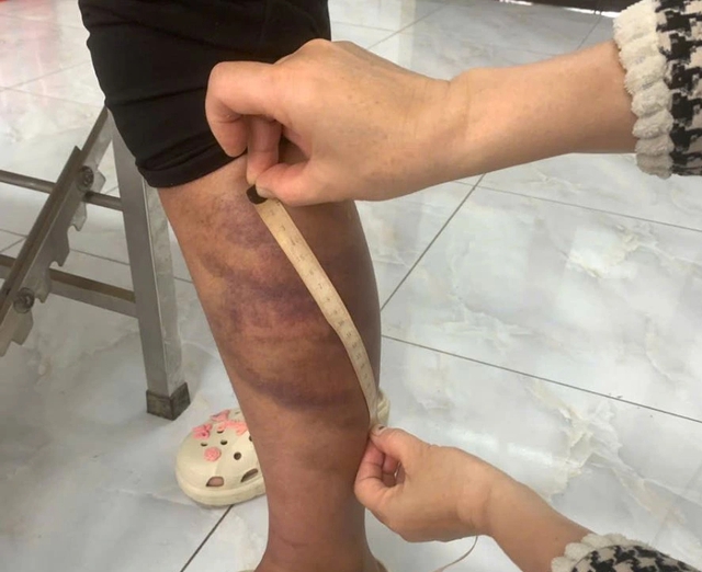 Tạm giữ đối tượng tr&oacute;i, đ&aacute;nh con ruột, h&agrave;nh hạ vợ mang thai  - Ảnh 2.