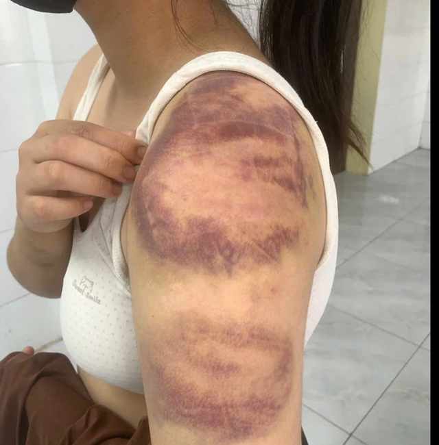 Tạm giữ đối tượng tr&oacute;i, đ&aacute;nh con ruột, h&agrave;nh hạ vợ mang thai  - Ảnh 1.