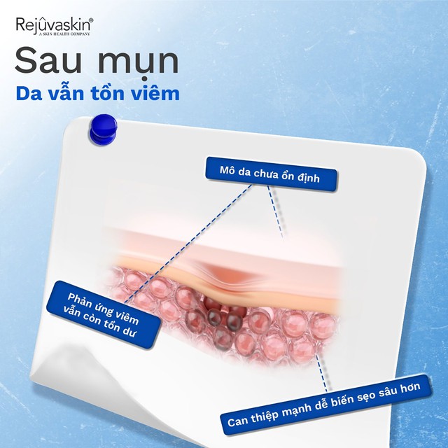 - Ảnh 1. - Ảnh 1.