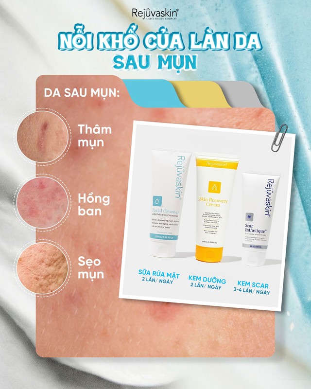 - Ảnh 3. - Ảnh 3.