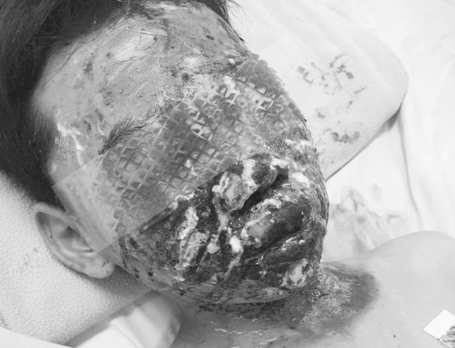 B&aacute;c sĩ cảnh b&aacute;o h&oacute;c dị vật, tai nạn ph&aacute;o nổ dịp cận Tết - Ảnh 2.