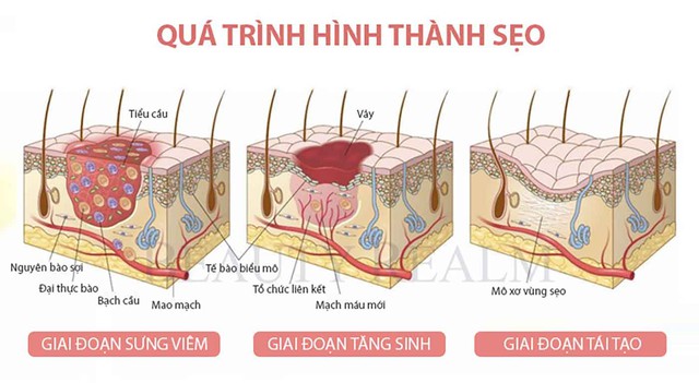 Khi nào da còn khả năng tăng sinh collagen để cải thiện?- Ảnh 2. Khi nào da còn khả năng tăng sinh collagen để cải thiện?- Ảnh 2.