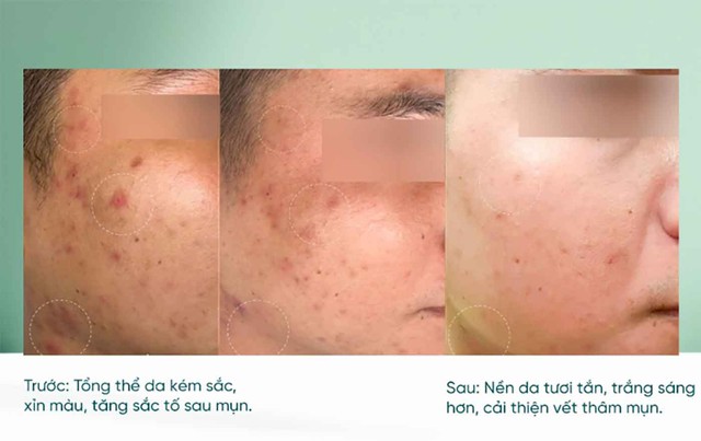 Top 3 serum vitamin C khiến làn da xỉn màu, lão hóa cỡ nào cũng tươi trẻ - Ảnh 3. Top 3 serum vitamin C khiến làn da xỉn màu, lão hóa cỡ nào cũng tươi trẻ - Ảnh 3.