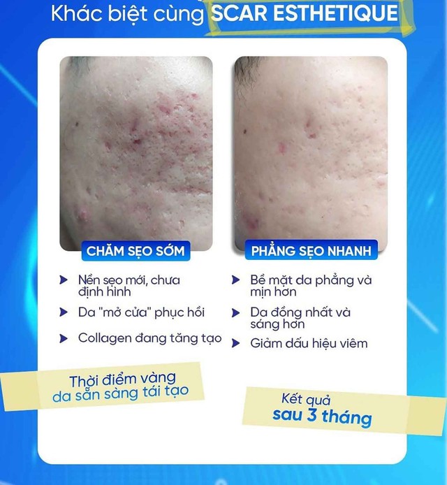 Khi nào da còn khả năng tăng sinh collagen để cải thiện?- Ảnh 3. Khi nào da còn khả năng tăng sinh collagen để cải thiện?- Ảnh 3.