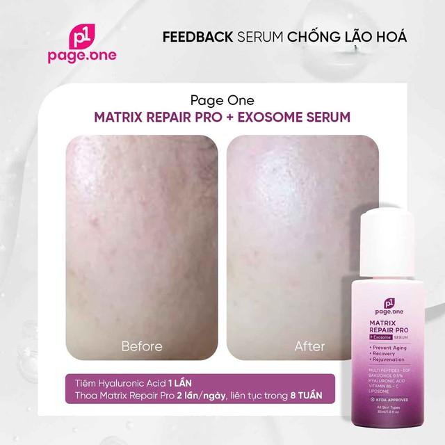 Top 3 serum vitamin C khiến làn da xỉn màu, lão hóa cỡ nào cũng tươi trẻ - Ảnh 7. Top 3 serum vitamin C khiến làn da xỉn màu, lão hóa cỡ nào cũng tươi trẻ - Ảnh 7.