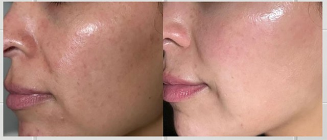 7 kem trắng da chống l&atilde;o h&oacute;a gi&uacute;p l&agrave;n da tuổi 40 căng trẻ, mịn m&agrave;ng - Ảnh 1.