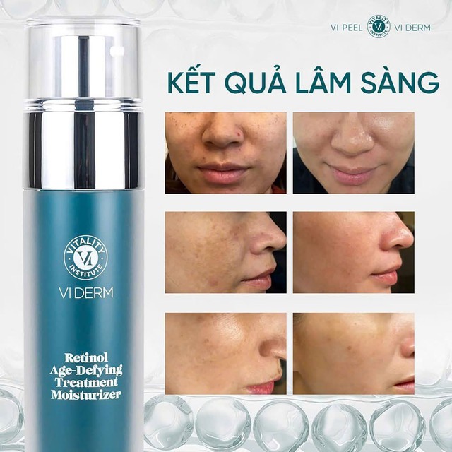 7 kem trắng da chống l&atilde;o h&oacute;a gi&uacute;p l&agrave;n da tuổi 40 căng trẻ, mịn m&agrave;ng - Ảnh 7.