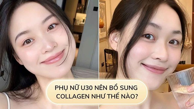Sau 30 tuổi, chị em mới bắt đầu bổ sung collagen c&oacute; phải l&agrave; qu&aacute; muộn? - Ảnh 1.