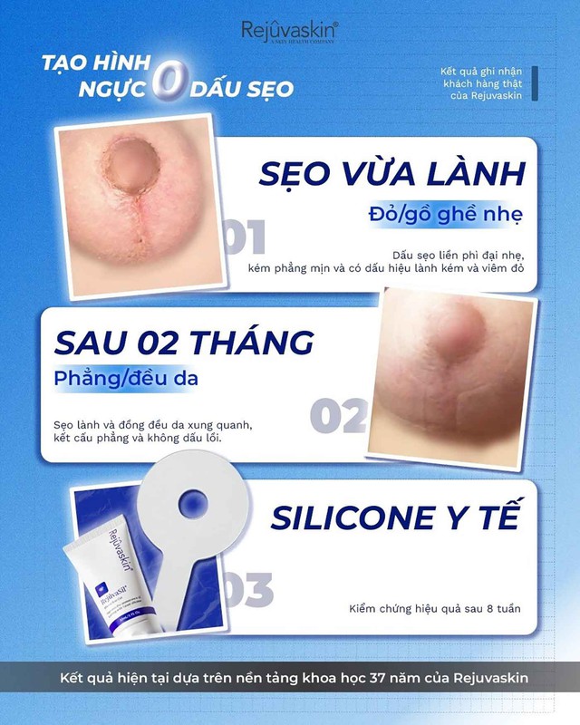 Vết thương sau bao l&acirc;u th&igrave; b&ocirc;i kem mờ sẹo để đạt hiệu quả sau 4-8 tuần?- Ảnh 7.