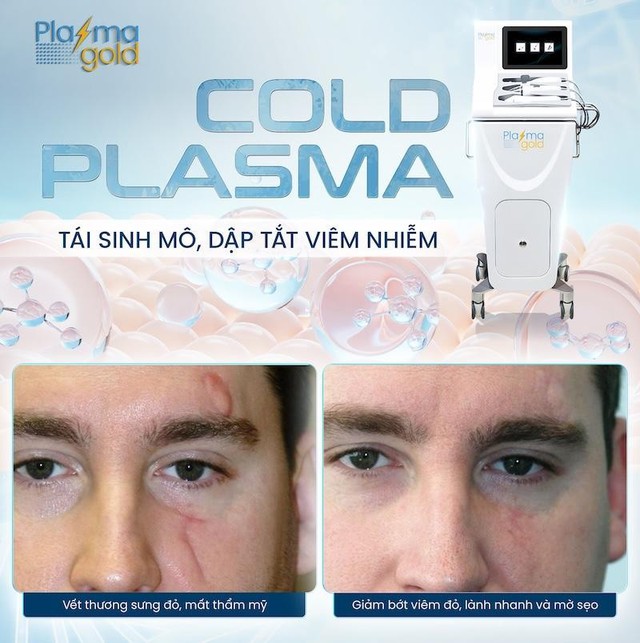 Quản trị rủi ro biến chứng hậu phẫu: Góc nhìn từ công nghệ Plasma lạnh - Ảnh 4.